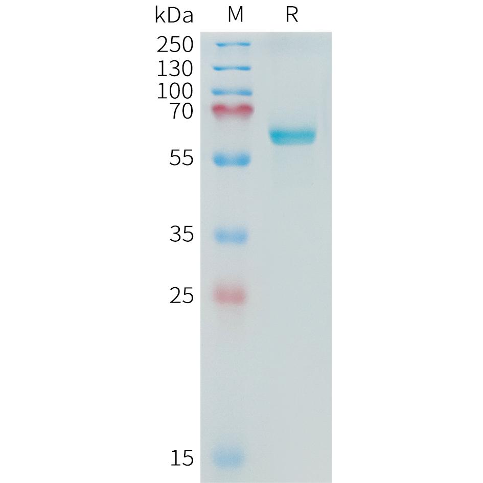 Cynomolgus ALPP Protein, His Tag