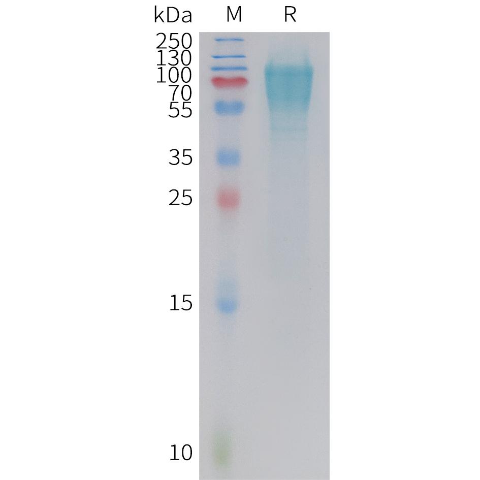 Cynomolgus GUCY2C Protein, His Tag