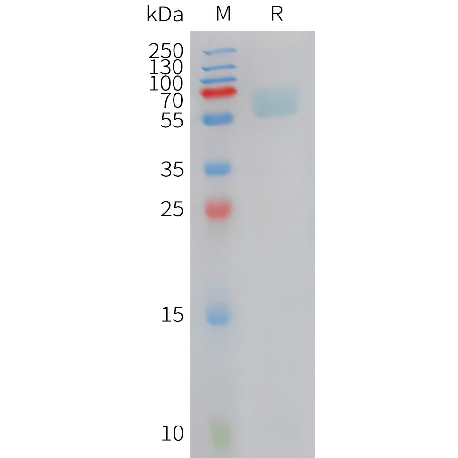 Cynomolgus AXL Protein, His Tag