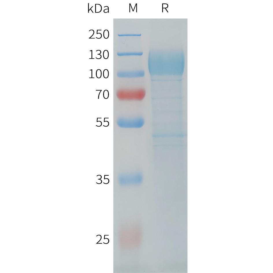 Cynomolgus CDH17 Protein, His Tag