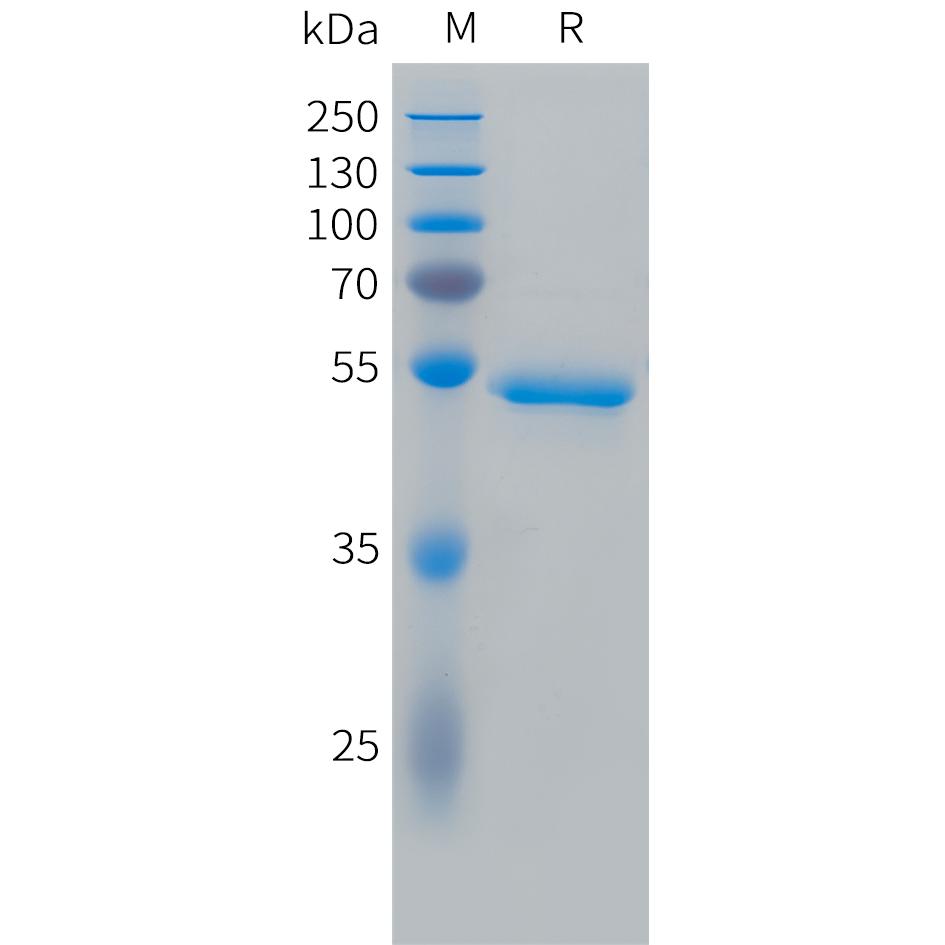 Cynomolgus CA9 Protein, His Tag