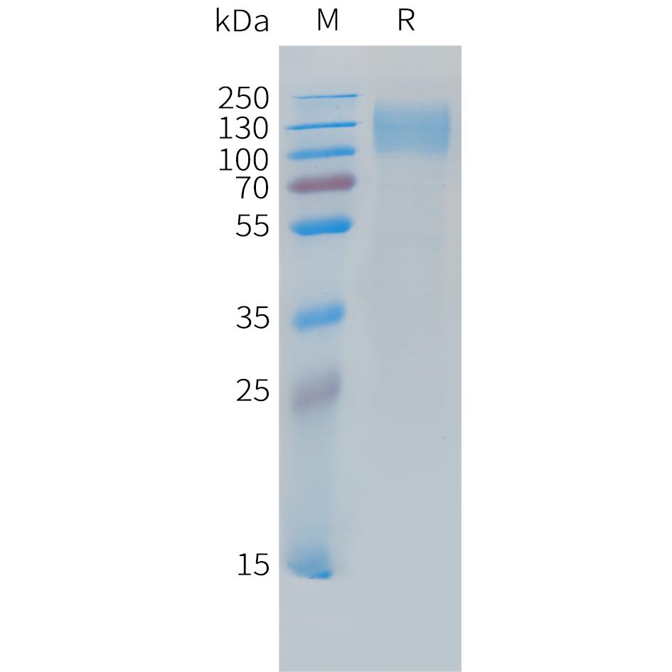 Cynomolgus CEACAM5 Protein, His Tag