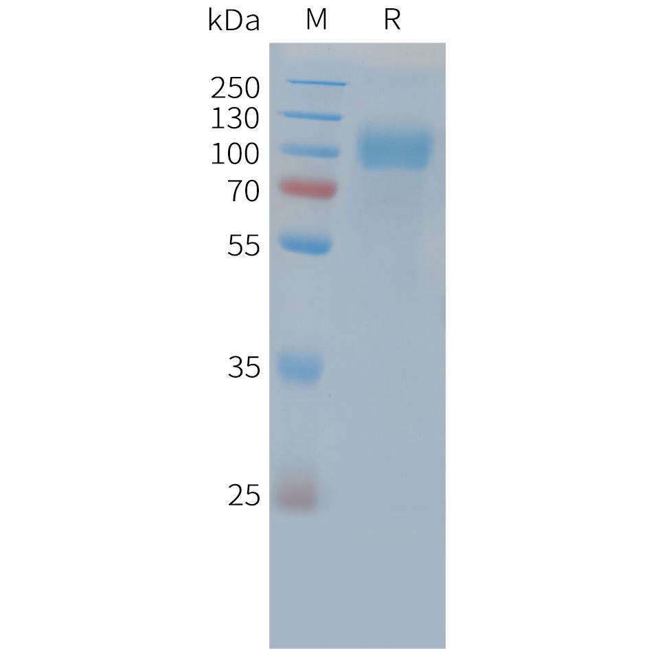 Cynomolgus EGFR Protein, His Tag