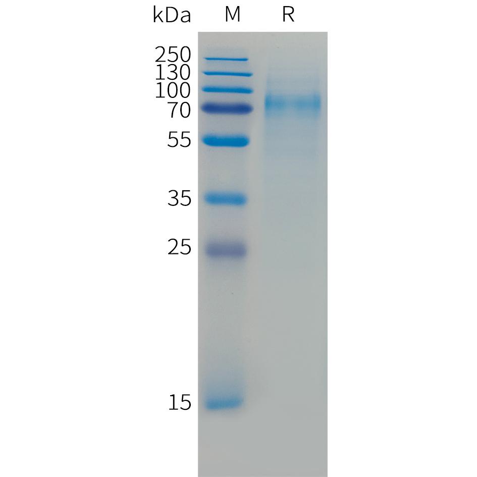 Cynomolgus CD30 Protein, His Tag