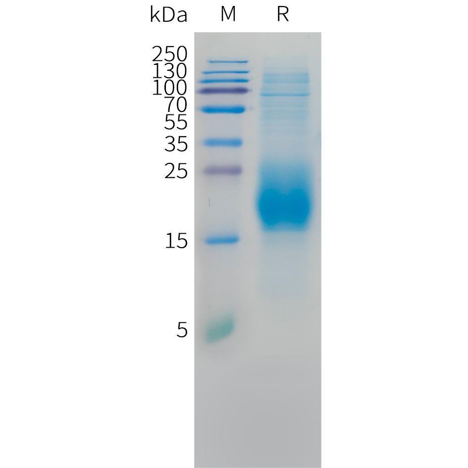 Cynomolgus CD3D Protein, His Tag