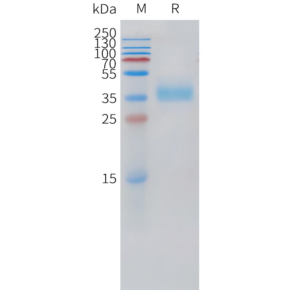 Cynomolgus Trop2 Protein, His Tag