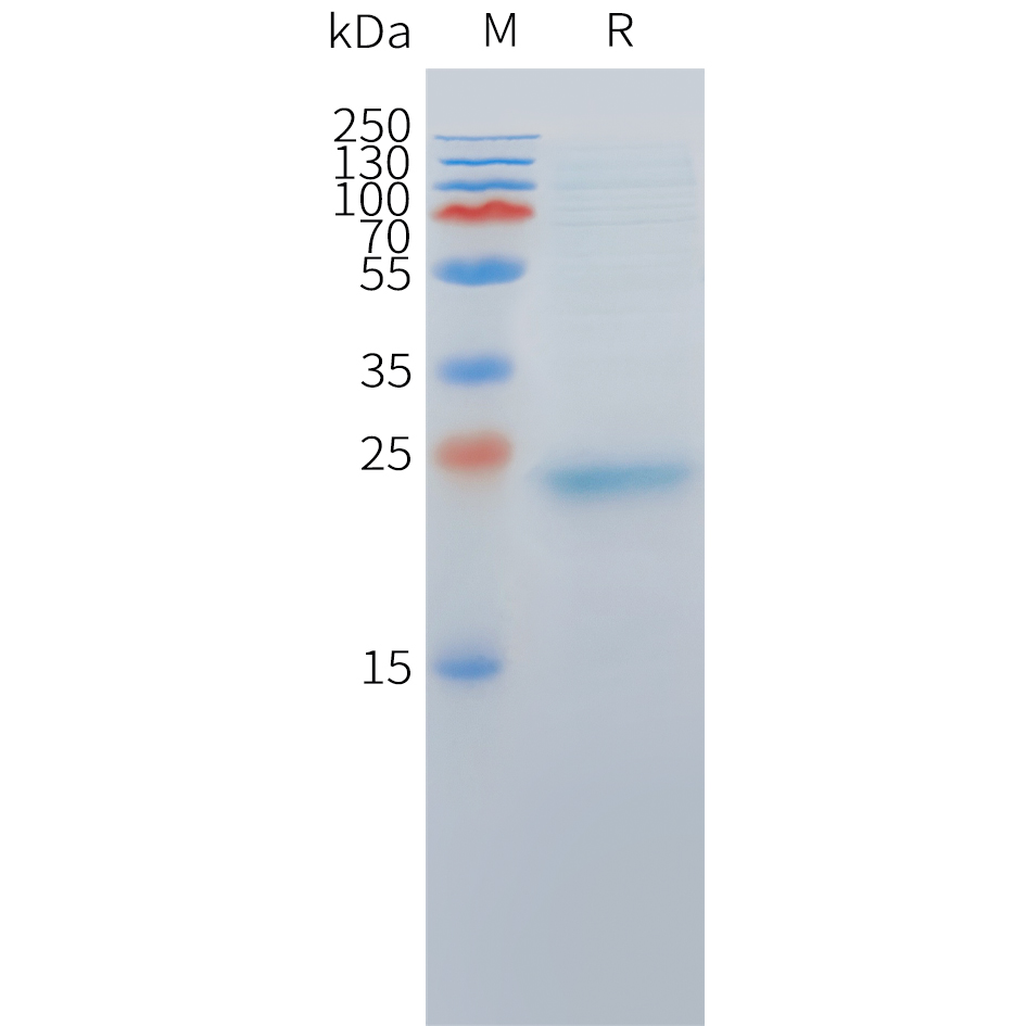 Cynomolgus DLL3(272-488) Protein, His Tag Cynomolgus DLL3(272-488) Protein, His Tag