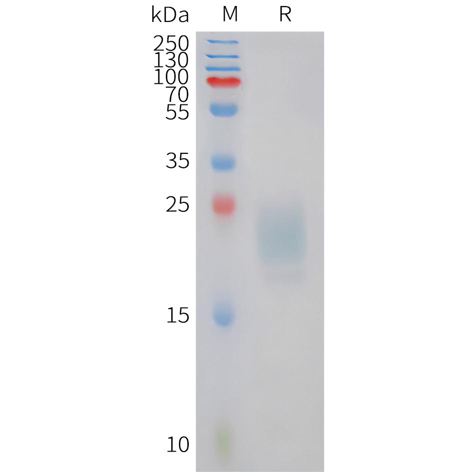 Feline IL31 Protein, His Tag