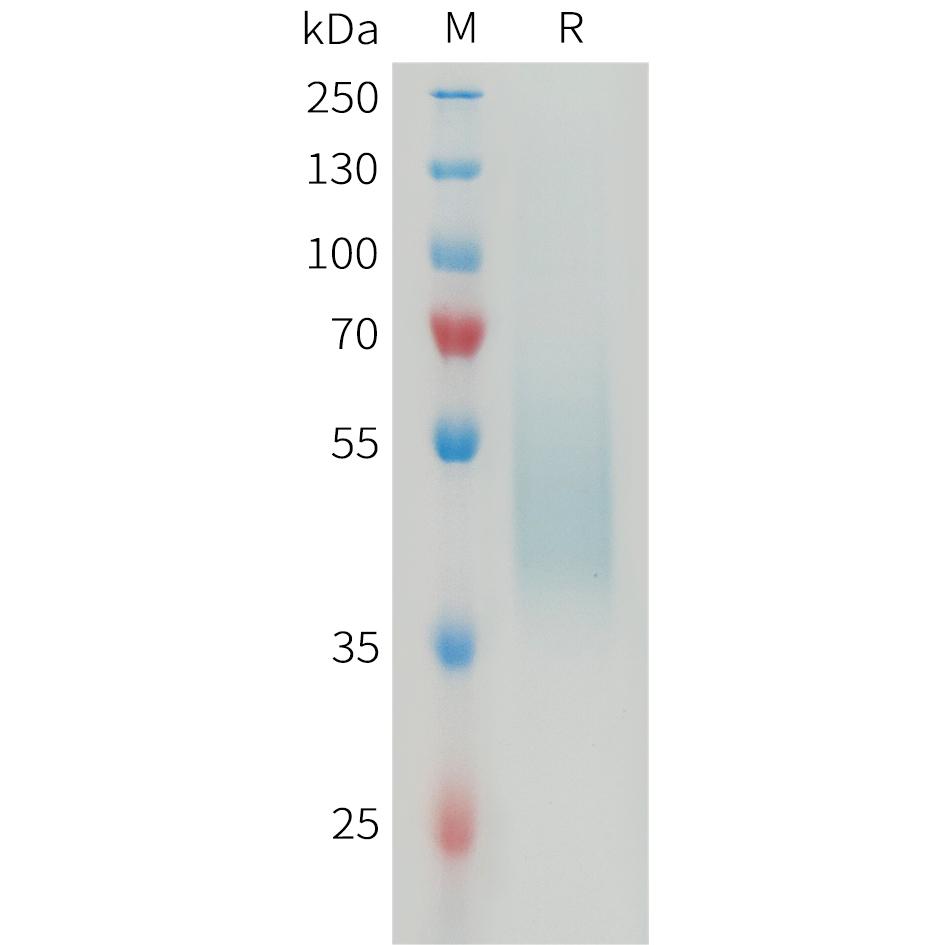 Mouse B7-H4 Protein, His Tag