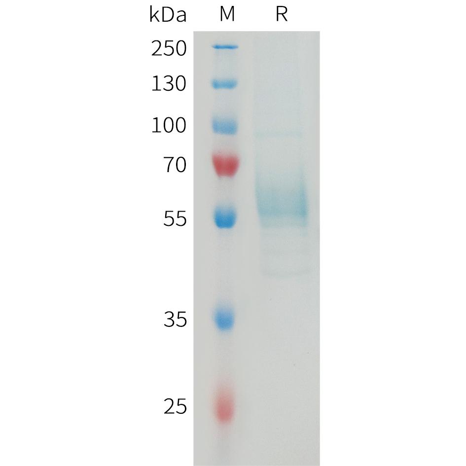 Mouse TREM2 Protein, hFc Tag