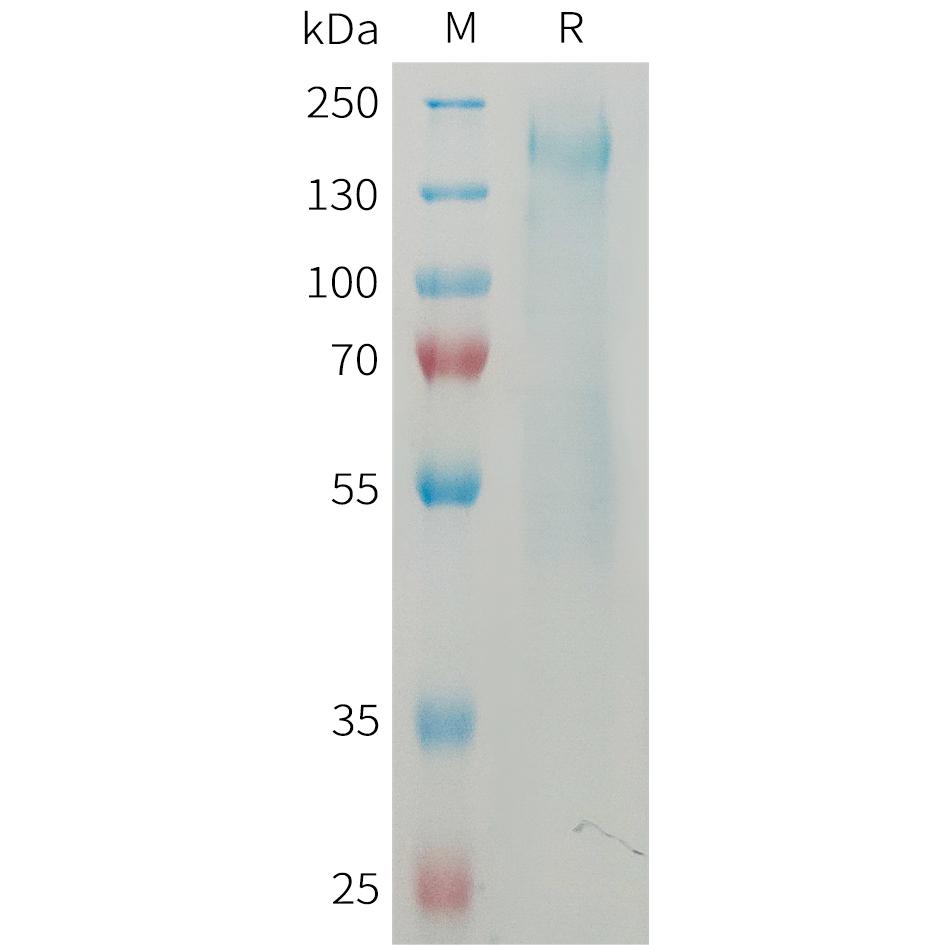 Mouse CD45 Protein, His Tag