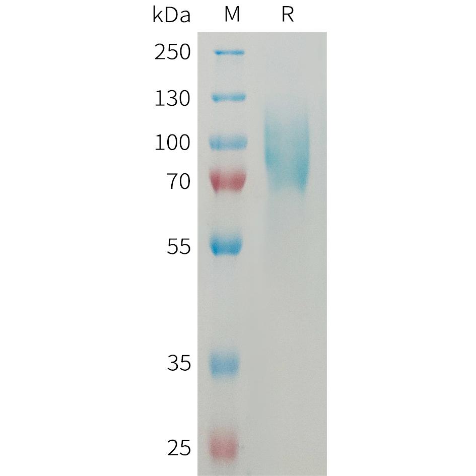 Mouse ICAM1 Protein, His Tag