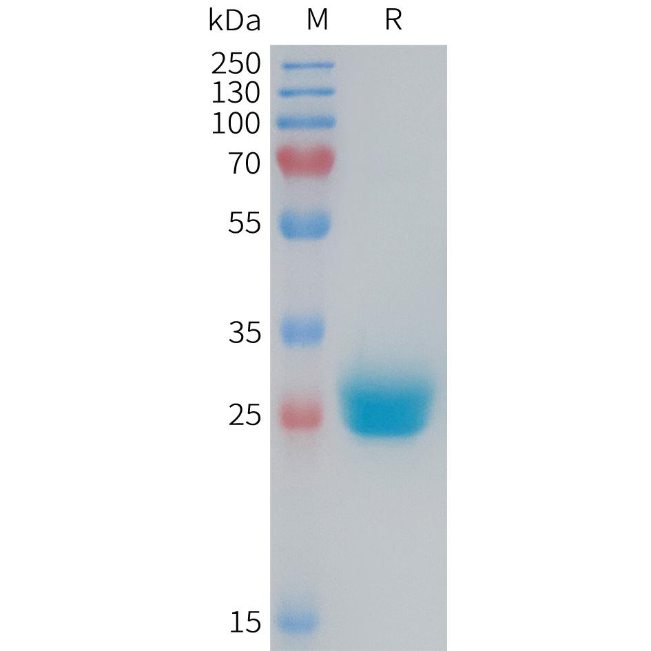 Mouse CXADR Protein, His Tag