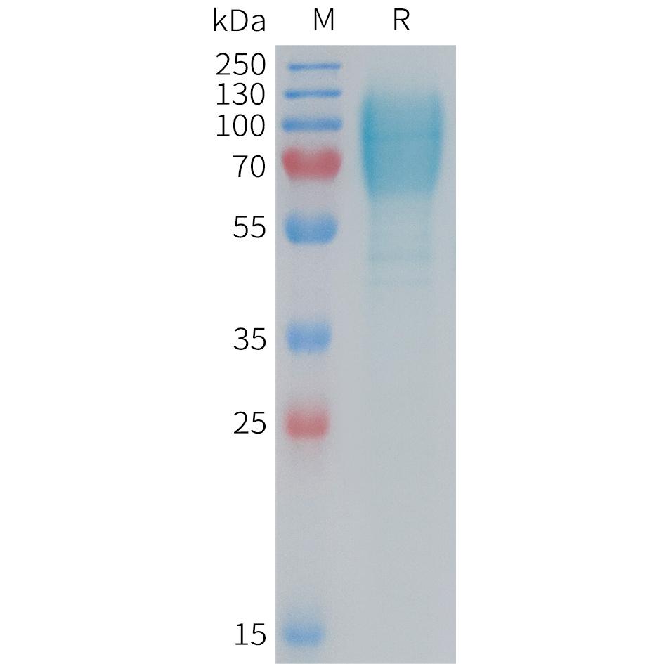 Mouse GUCY2C Protein, His Tag