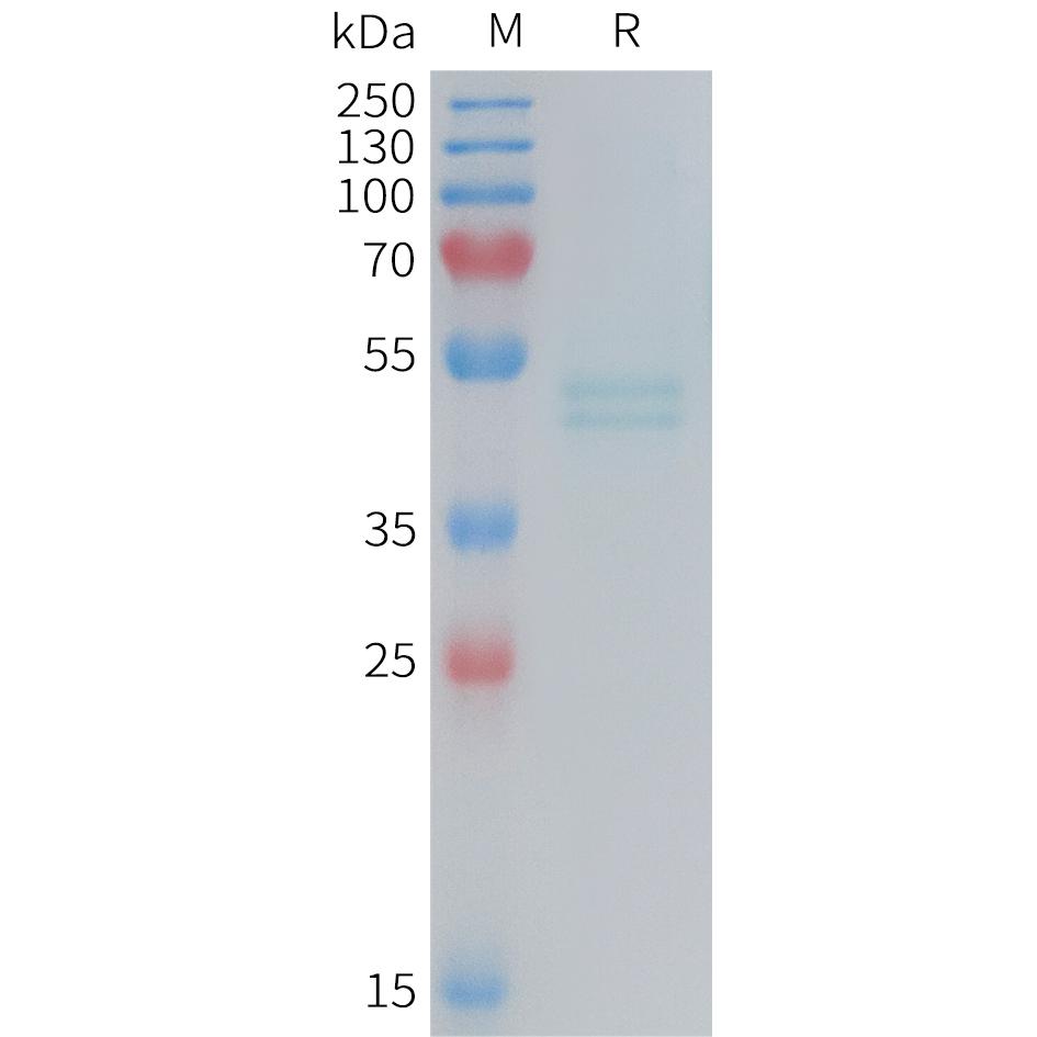 Mouse IL11RA Protein, His Tag