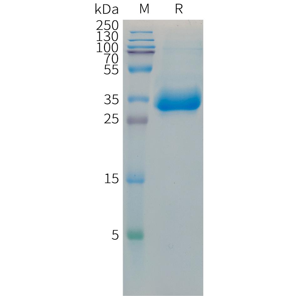 Mouse HistoneH1.2 Protein, hFc Tag