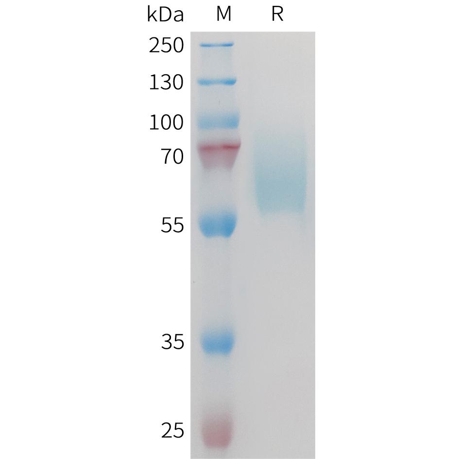 Mouse AXL Protein, His Tag