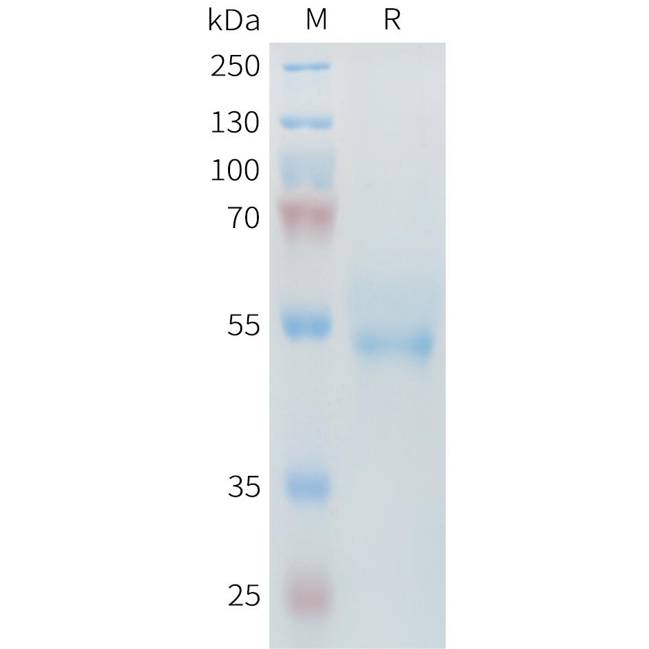 Mouse ROR2 Protein, His Tag