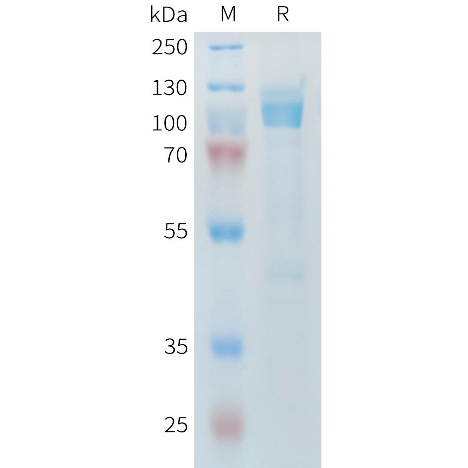 Mouse CDH17 Protein, His Tag