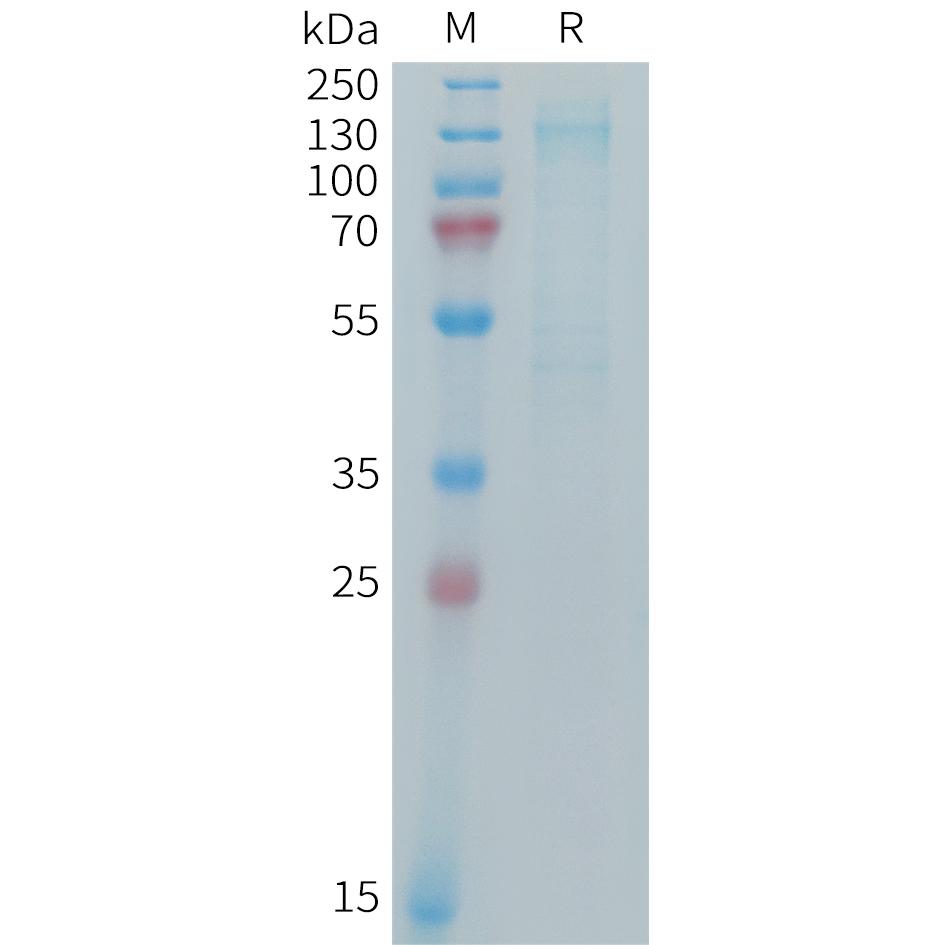 Mouse IGF-1R Protein, His Tag