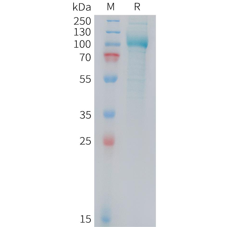 Mouse PSMA Protein, His Tag