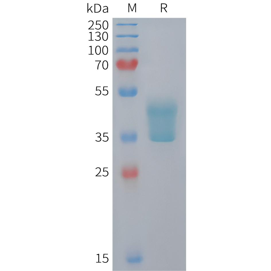 Mouse CCR2 Protein, hFc Tag