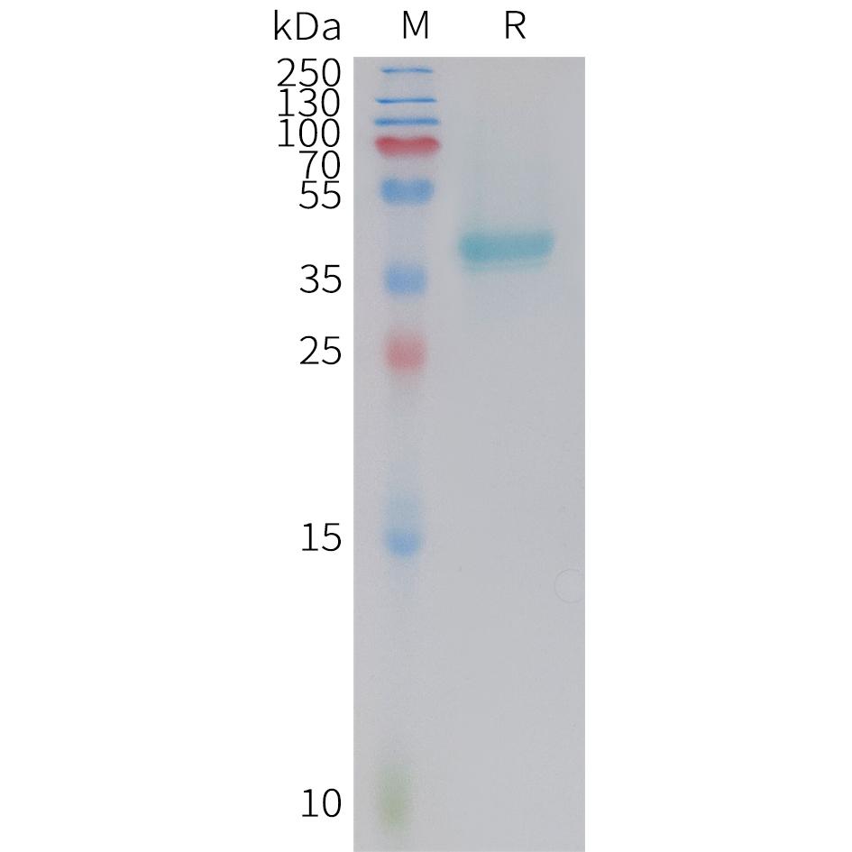 Mouse Nectin-4 Protein, His Tag