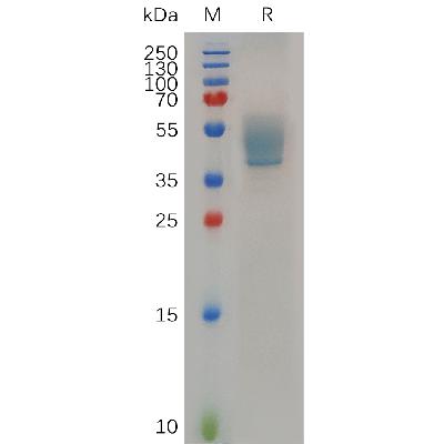 Human USH2A Protein, hFc Tag