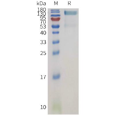 Human PTPRG Protein, His Tag