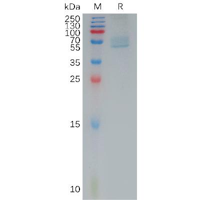 Human TRPV1 Protein, hFc Tag