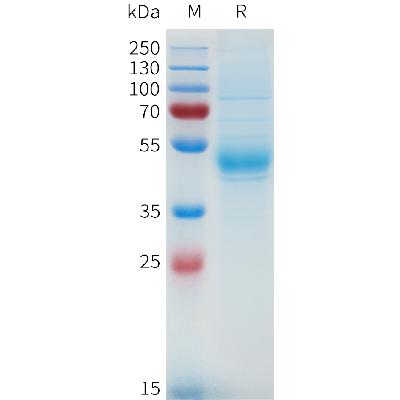 Human MET(516-656) Protein, hFc Tag