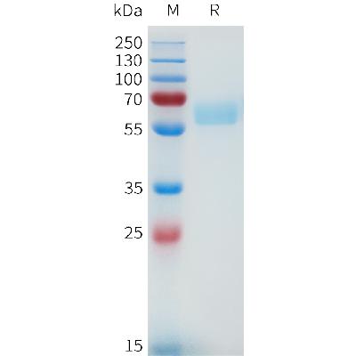 Human MET(740-932) Protein, hFc Tag