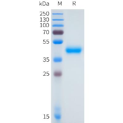 Human GPA33(135-235) Protein, hFc Tag