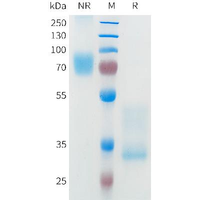 Human MET(25-562) Protein, His Tag