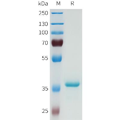 Human DLL3(352-390) Protein, hFc Tag