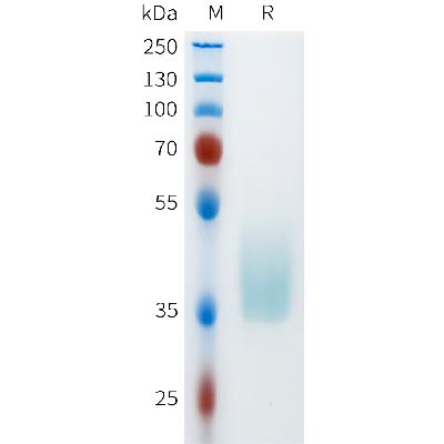 Cynomolgus CD142 Protein, His Tag