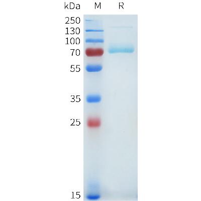 Cynomolgus TFRC Protein, His Tag