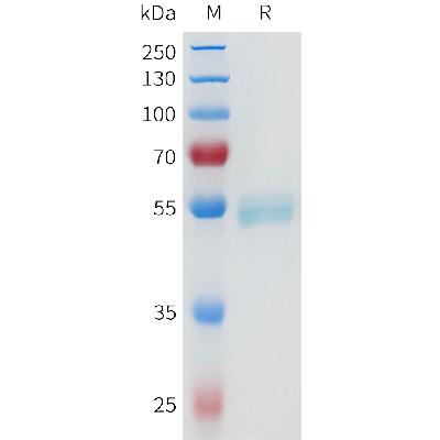 Human CD4 Protein, His Tag