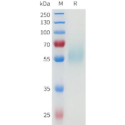 Human EGFR(25-389) Protein, His Tag