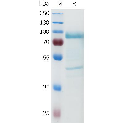 Human HGF Protein, Flag Tag