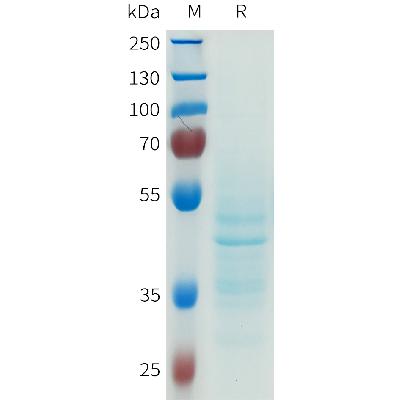 Human CDH6(269-383) Protein, hFc Tag