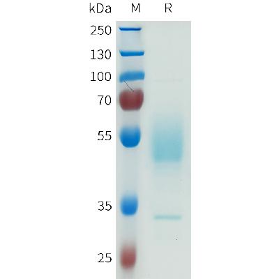 Human CDH6(384-486) Protein, hFc Tag