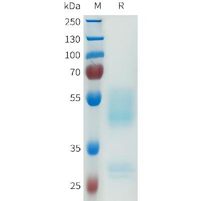 Human PRLHR Protein, hFc Tag