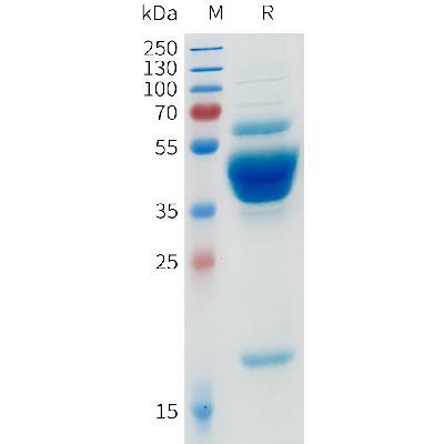 Human BAFF Protein, mFc-His Tag