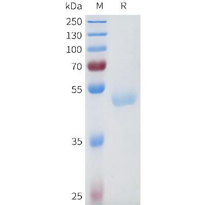 Human CTSD Protein, His Tag