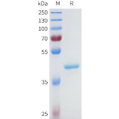 Human CTSL Protein, His Tag