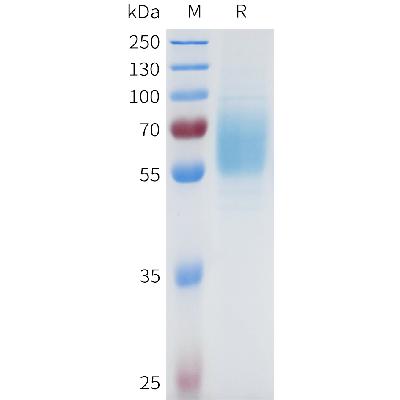 Human EGFR(301-645) Protein, His Tag