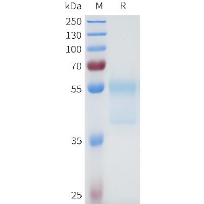 Human 5T4(32-91) Protein, hFc Tag