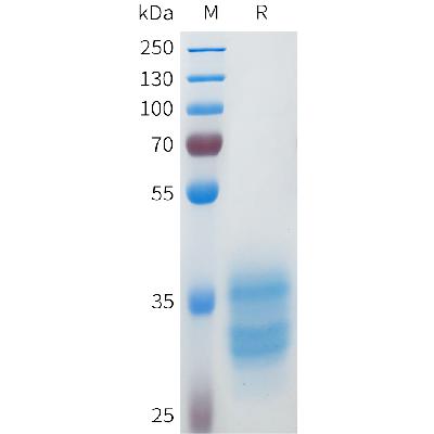 Human 5T4(114-140) Protein, hFc Tag