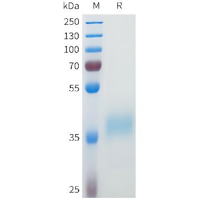 Human 5T4(140-171) Protein, hFc Tag